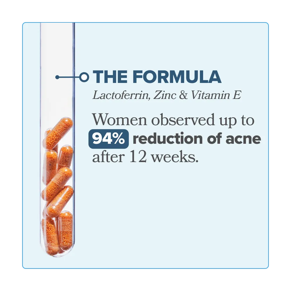RETRO - Acne Relief Vitamin Capsules